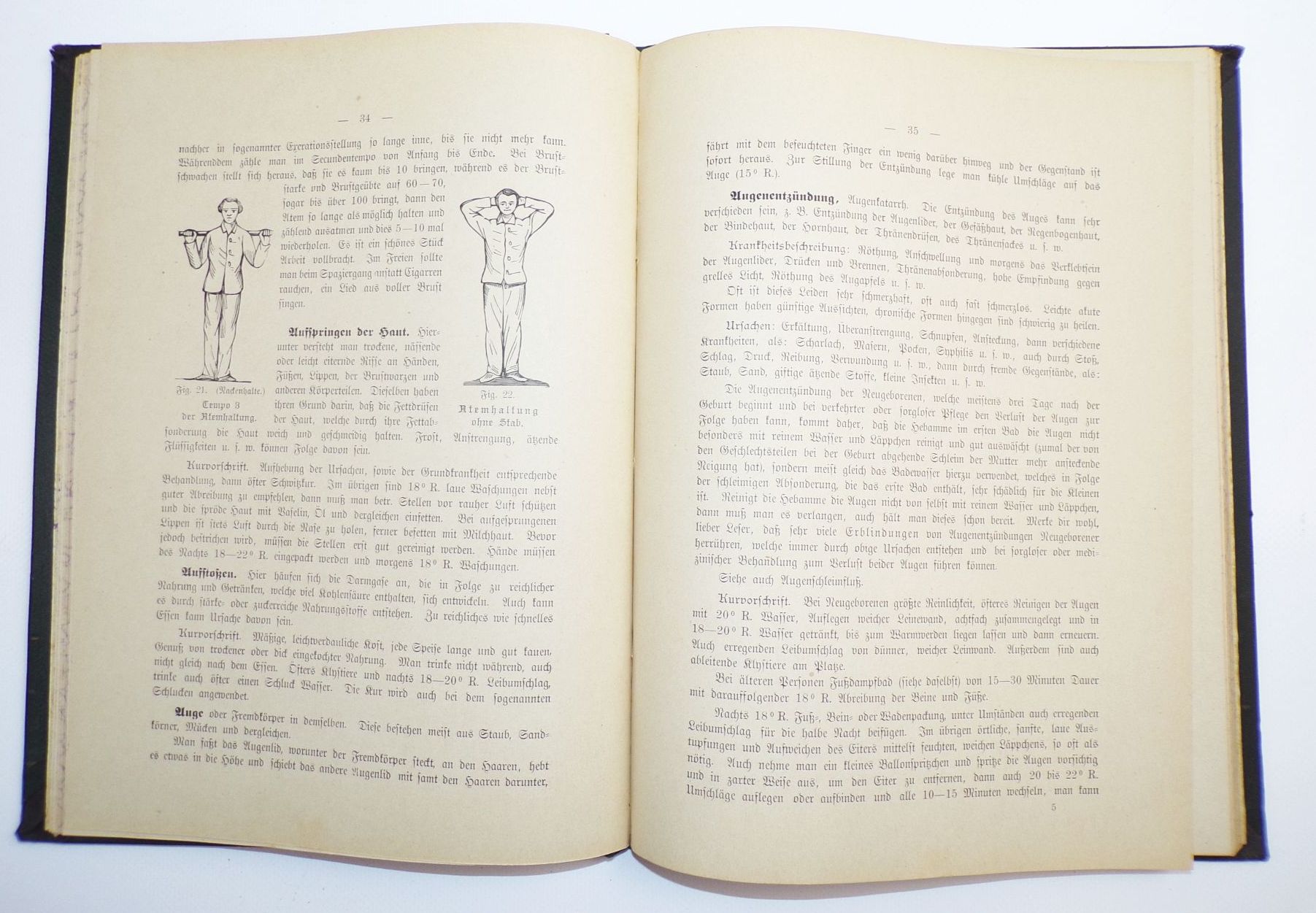 Die Natur und Wasser Heilkunde Koch 1894