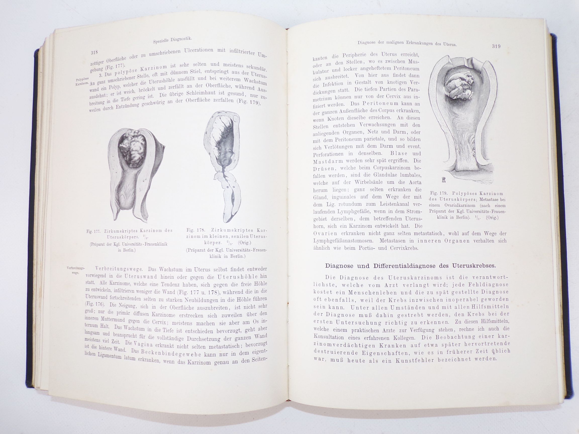 Lehrbuch der gynäkologischen Diagnostik 1907 Winter Frauenheilkunde Buch 